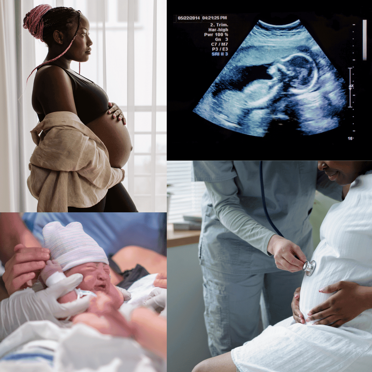 Pregnancy baby scan